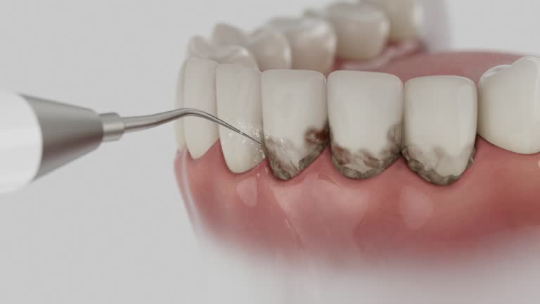 Trusted Tooth Extraction service in Poth, TX - Dentist Open Now